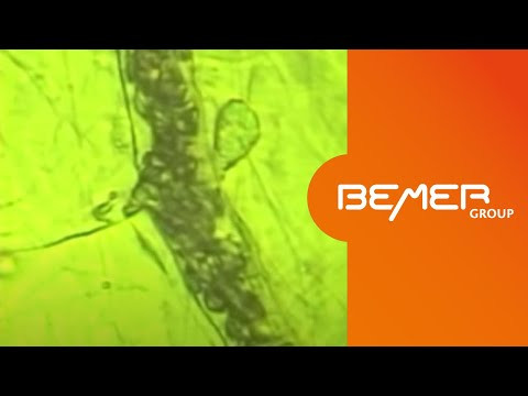 Der BEMER Effekt – mikroskopische Demonstration der Wirkung auf die Mikrozirkulation | DE