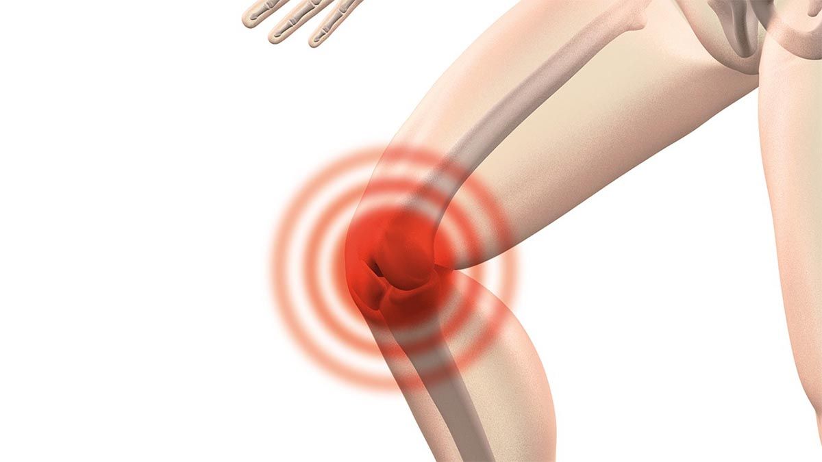 Arthrose im Knie: Behandlung mit Hyaluronsäure und PRP kniearthrose