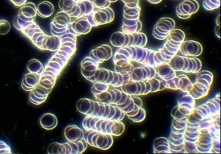 uebersaeuertes blut geldrollenphaenomen