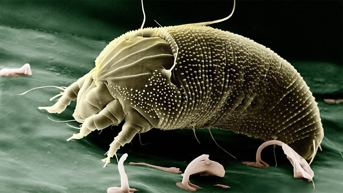 Parasitäre Belastung milbe-mikroskop